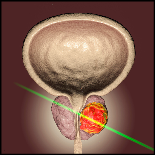 Prosto Max Supplement Prosto Max review result no.3